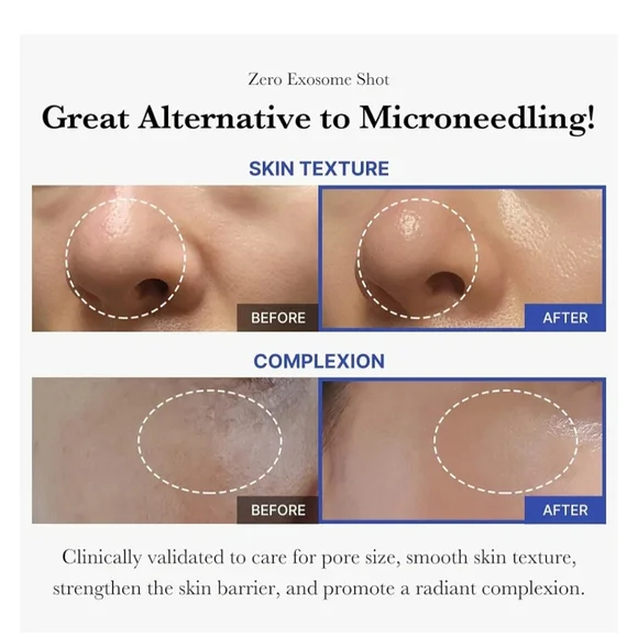 COPY - Medicube Exosome Shot 2000 Viral Skincare Product - Picture 9 of 12